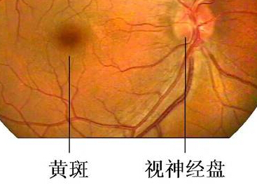 贵阳治疗黄斑病变医院哪家好?