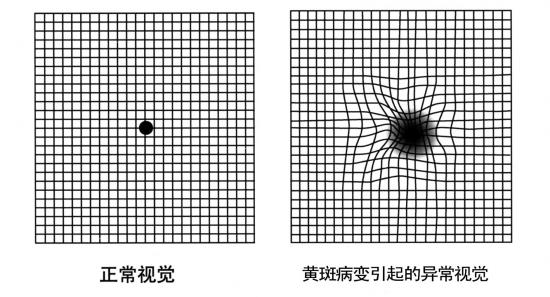 贵阳眼底病医院