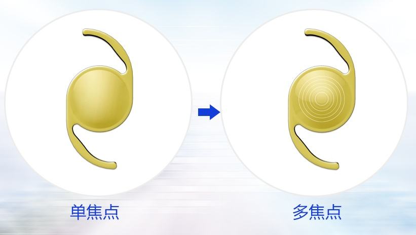 治疗老花的克星：多焦点人工晶体置换术