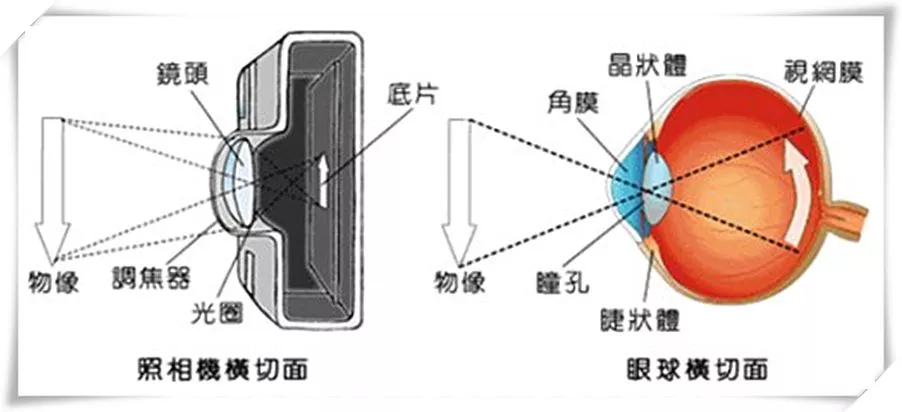 你所不知道的关于角膜移植的那些事儿