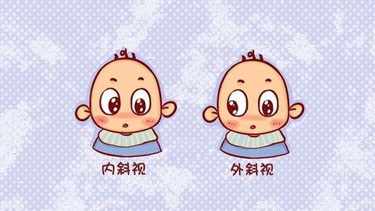 关于斜视，你知道多少？