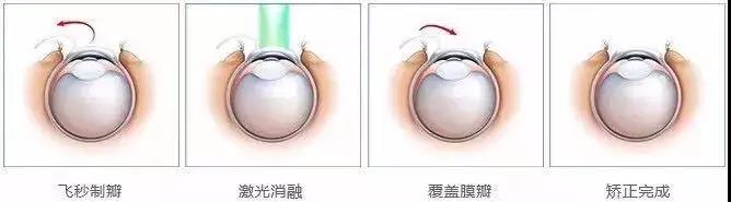 山花烂漫，你的“桃花”却被眼镜阻隔!