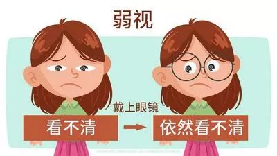 孩子视力不好就一定是近视吗？