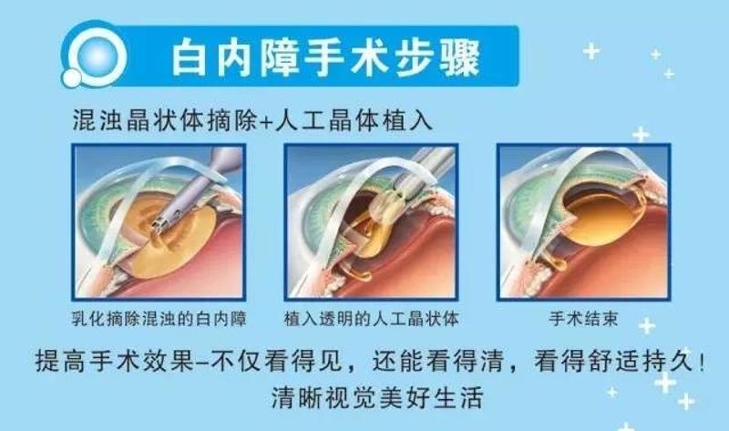 白内障术前术后注意事项